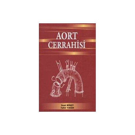 AORT Cerrahisi