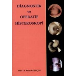 Diagnostik ve Operatif Histeroskopi