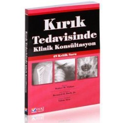 Kırık Tedavisinde Klinik Konsültasyon 49 Kritik Soru