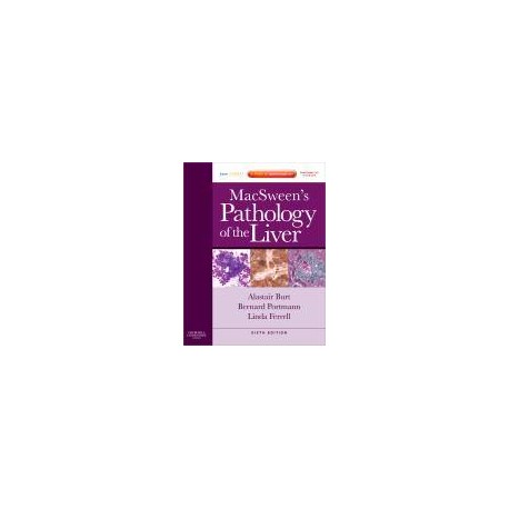 MacSween's Pathology of the Liver, 6th Edition