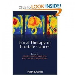 FOCAL THERAPY IN PROSTATE CANCER