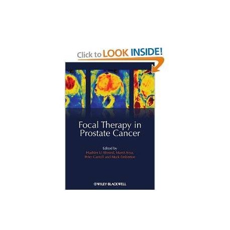 FOCAL THERAPY IN PROSTATE CANCER