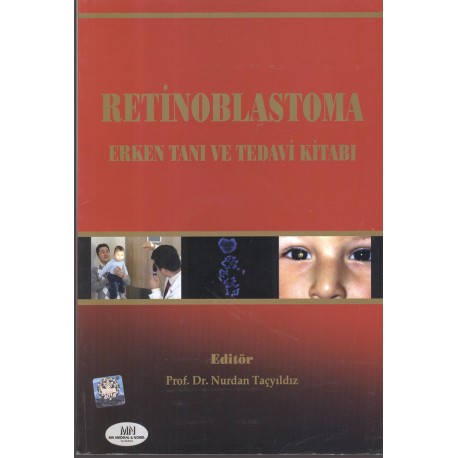 Retinoblastoma Erken Tanı Ve Tedavi Kitabı