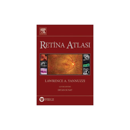 Yannuzzi Retina Atlası,Türkçe 2013 Baskı