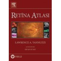 Yannuzzi Retina Atlası