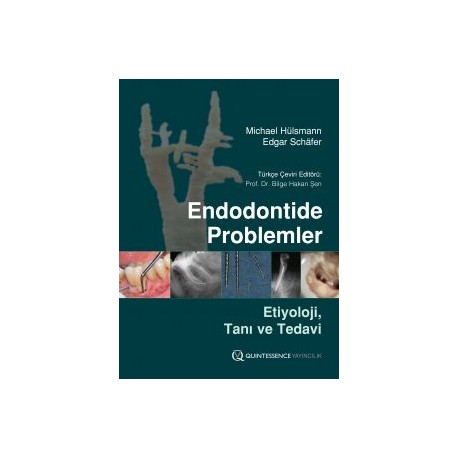 Endodontide Problemler - Etiyoloji, Tanı ve Tedavi