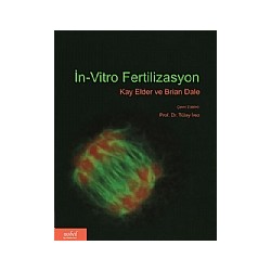 İn-Vitro Fertilizasyon