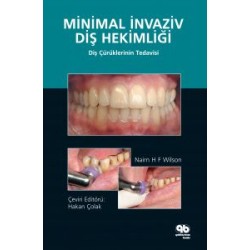 Minimal İnvaziv Diş Hekimliği Diş Çürüklerinin Tedavisi