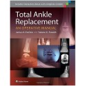 Total Ankle Replacement: An Operative Manual First Edition