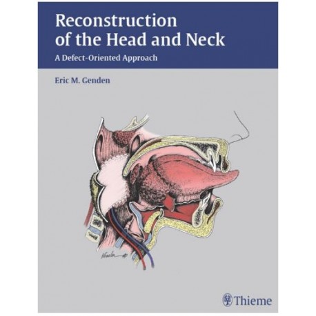 Reconstruction of the Head and Neck: A Defect-Oriented Approach 1st Edition