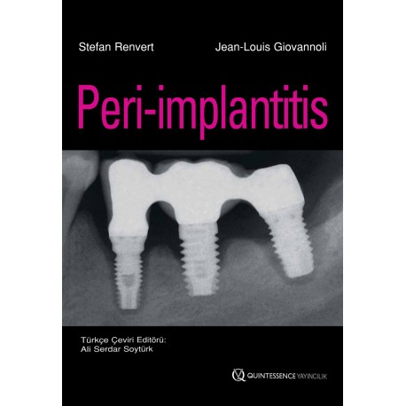 Peri-implantitis