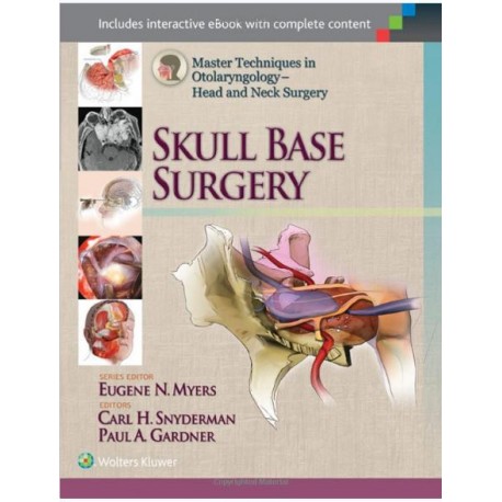 Master Techniques in Otolaryngology - Head and Neck Surgery: Skull Base Surgery 1st Edition