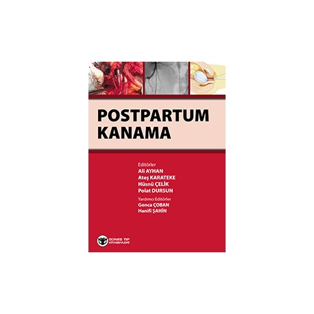 Postpartum Kanama