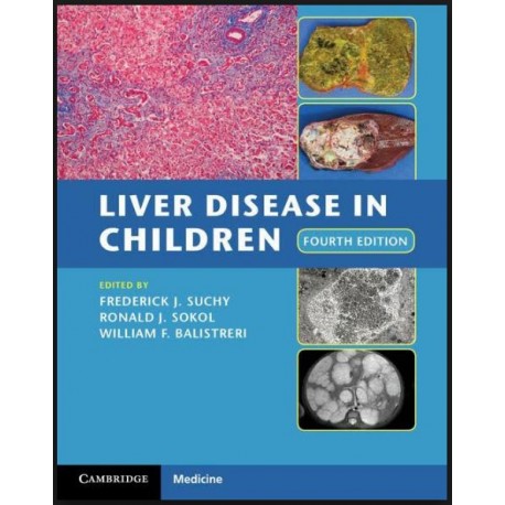 Liver Disease in Children