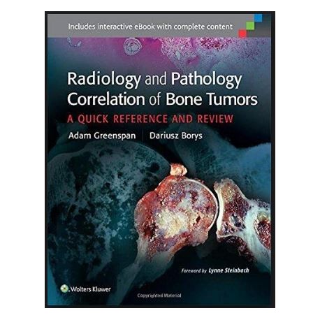 Radiology and Pathology Correlation of Bone Tumors: A Quick Reference and Review