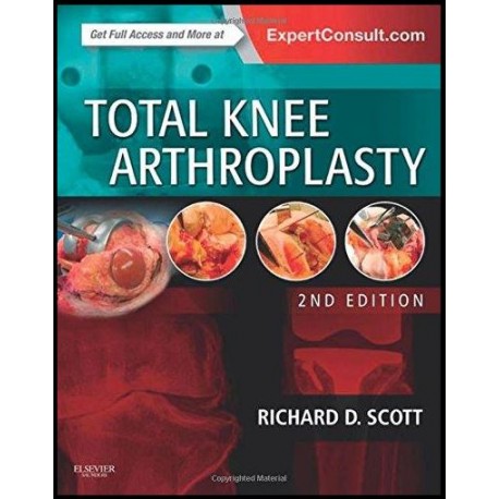 Total Knee Arthroplasty, 2e