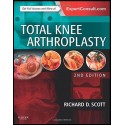 Total Knee Arthroplasty, 2e