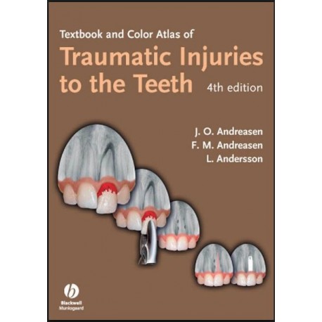 Textbook and Color Atlas of Traumatic Injuries to the Teeth