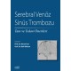 Serebral Venöz Sinüs Trombozu: Tanı ve Tedavi Önerileri