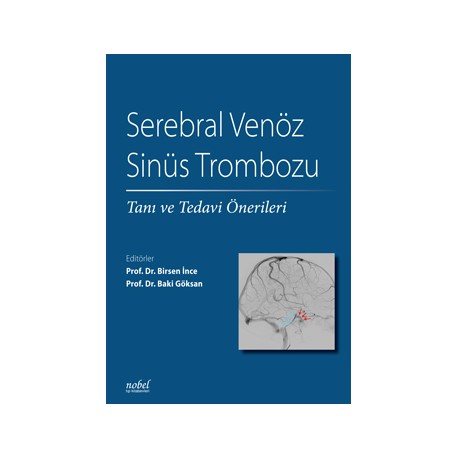 Serebral Venöz Sinüs Trombozu: Tanı ve Tedavi Önerileri