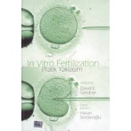 In Vitro Fertilization Pratik Yaklaşım