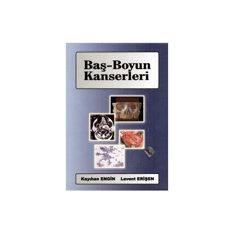 Baş-Boyun Kanserleri