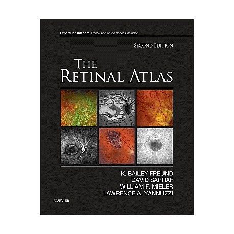 The Retinal Atlas