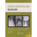 Göğüs Görüntüleme Olguları