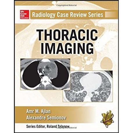 Radiology Case Review Series: Thoracic Imaging