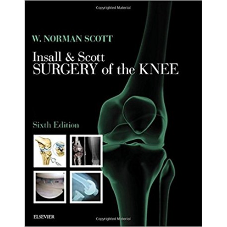 Insall & Scott Surgery of the Knee 2-Volume Set