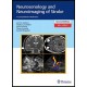 Neurosonology and Neuroimaging of Stroke: A Comprehensive Reference 2nd edition Edition