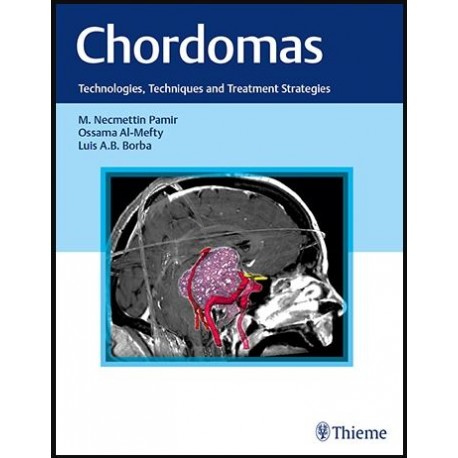 Chordomas: Technologies, Techniques, and Treatment Strategies 1st Edition