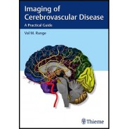 Imaging of Cerebrovascular Disease: A Practical Guide 1st Edition