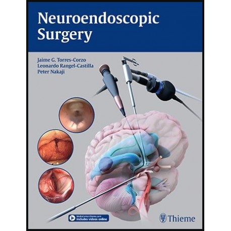 Neuroendoscopic Surgery