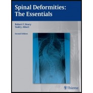 Spinal Deformities: The Essentials 2nd Edition