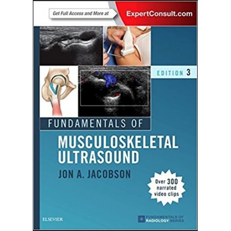 Fundamentals of Musculoskeletal Ultrasound