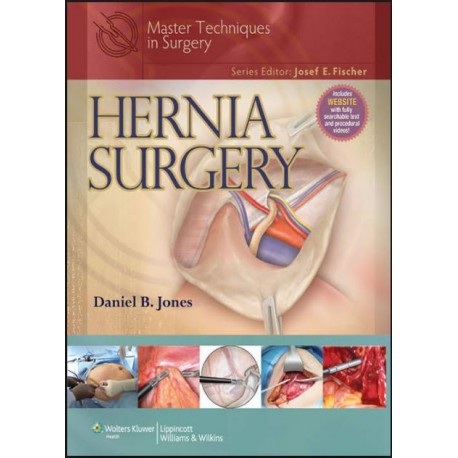 Master Techniques in Surgery: Hernia