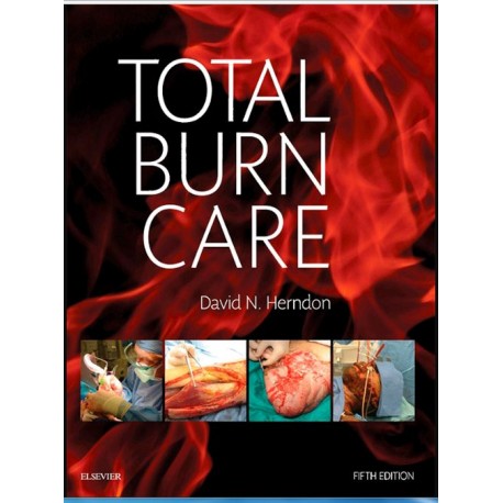 Total Burn Care