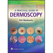 A Practical Guide to Dermoscopy