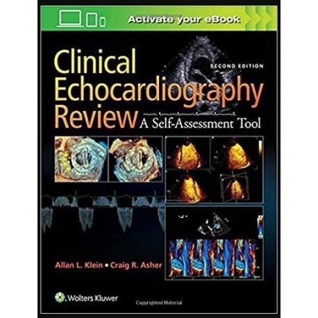 Clinical Echocardiography Review