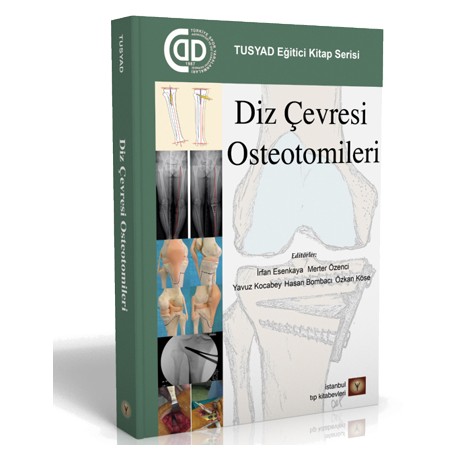 Diz Çevresi Osteotomileri