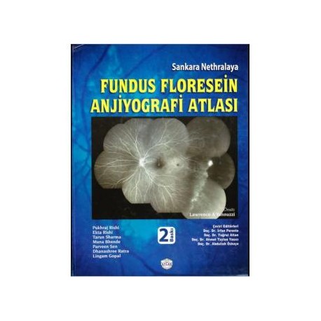 Fundus Floresein Anjiyografi Atlası