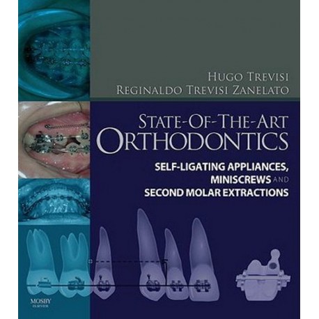 State of the Art Orthodontics