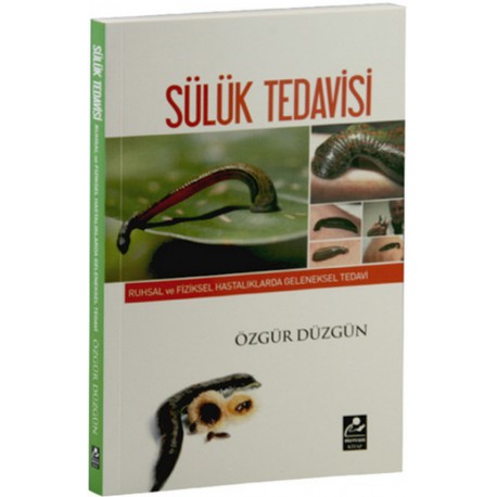 Sülük Tedavisi