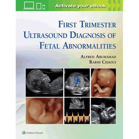 First Trimester Ultrasound Diagnosis of Fetal Abnormalities