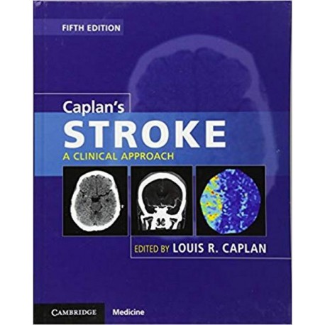 Caplan's Stroke: A Clinical Approach