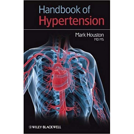 Handbook of Hypertension