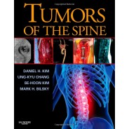 Tumors of the Spine 