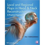 Local and Regional Flaps in Head and Neck Reconstruction: A Practical Approach