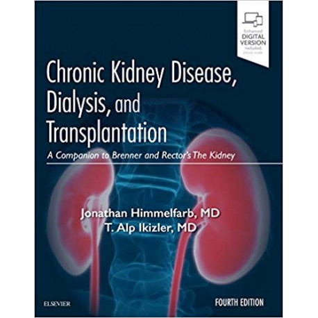 Chronic Kidney Disease, Dialysis, and Transplantation, 4th Edition